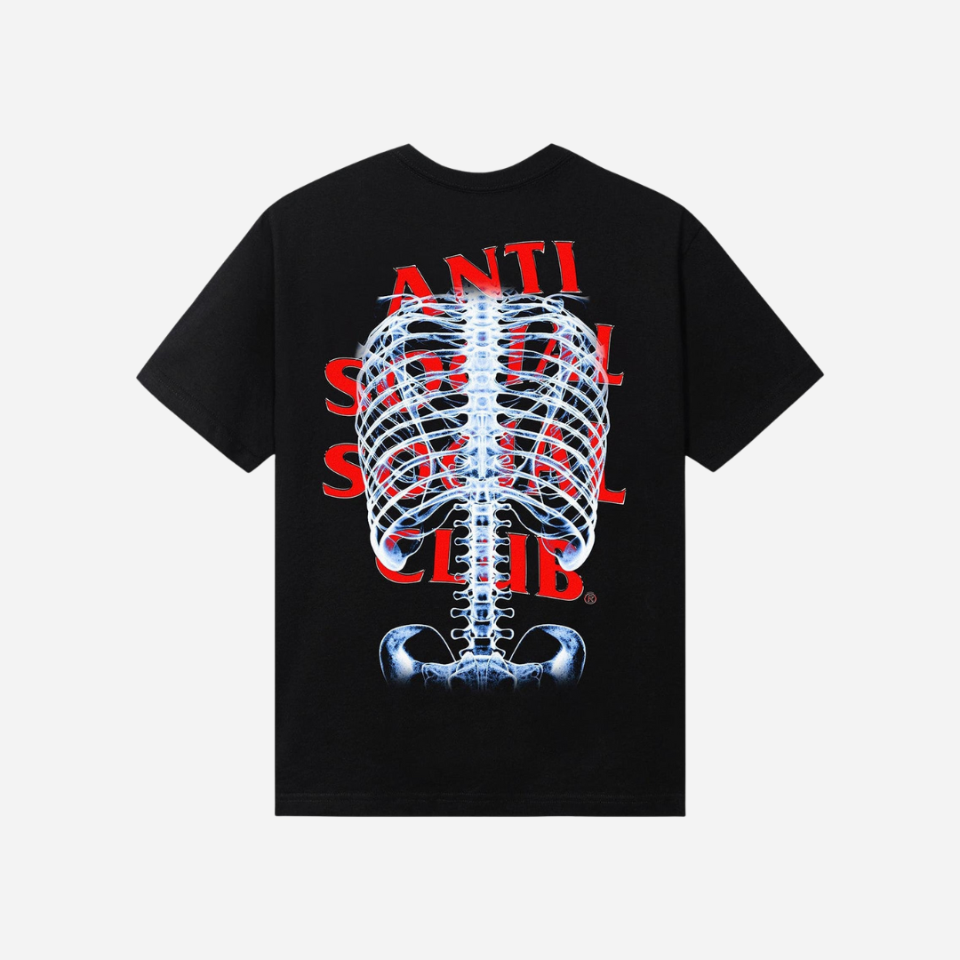 ANTI SOCIAL SOCIAL CLUB BONES TEE 'BLACK'